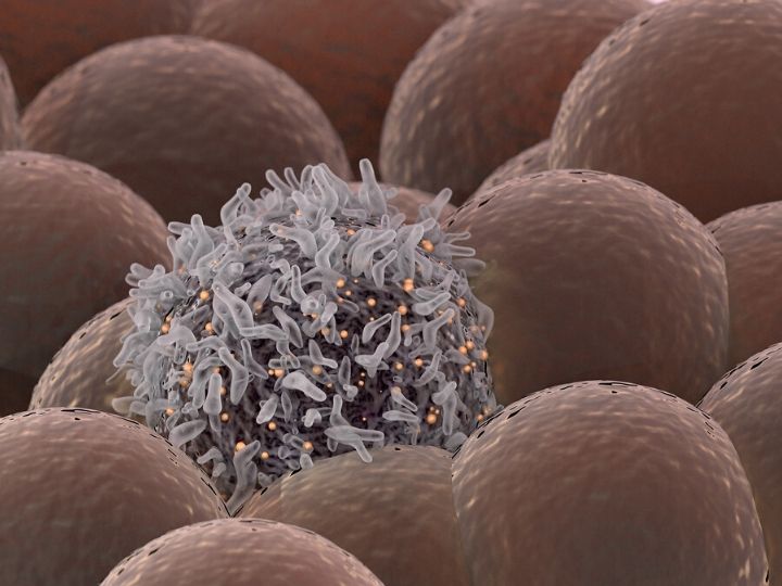 Cancer cell